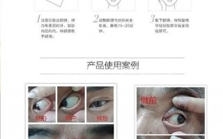 视力矫正到多少，视力矫正到多少度合适